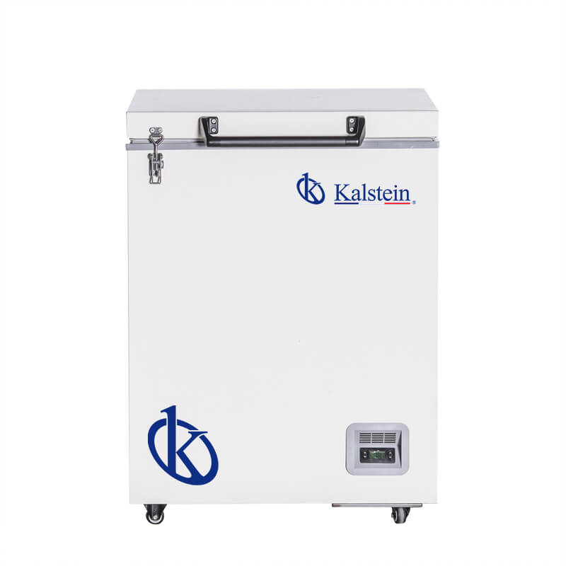Chest Freezers: Best Techniques and Protocols in 2026