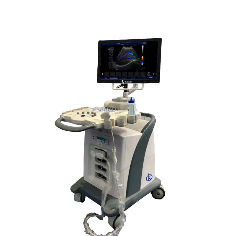 Discovering the Superior Performance of Kalstein Ultrasound Scanners