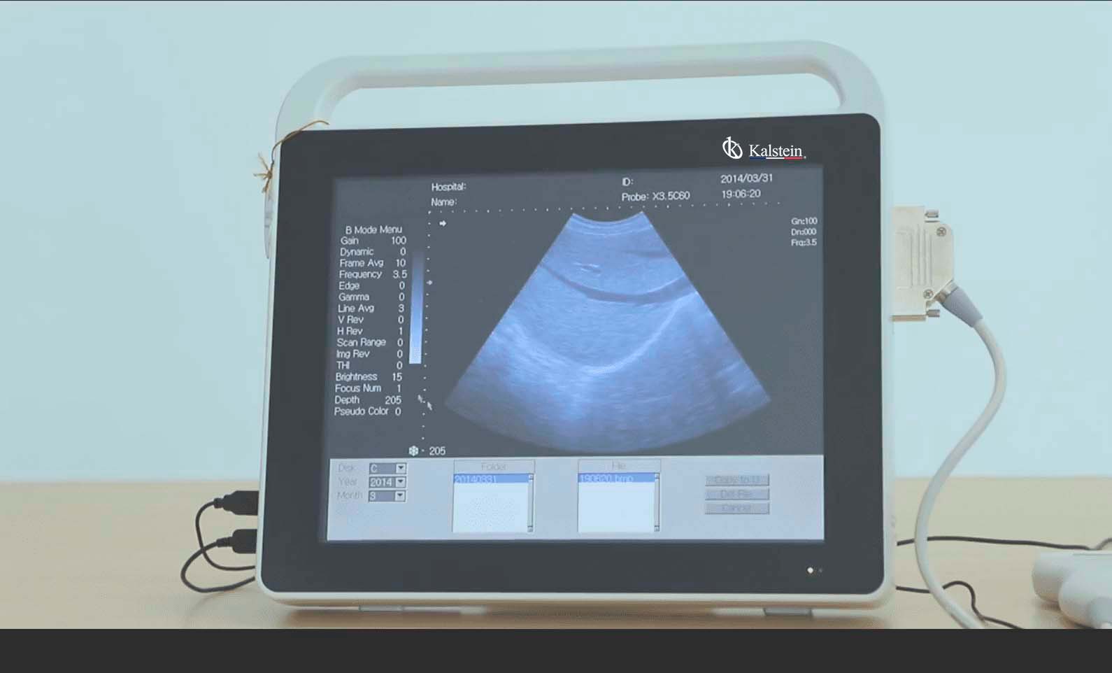 Ultrasound scan: characteristics and types