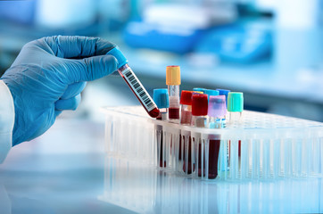 How is DNA measured with the fluorometer?